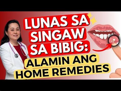 kinantot sa bibig|Singaw sa bibig: Dahilan, lunas at paano makakaiwas.